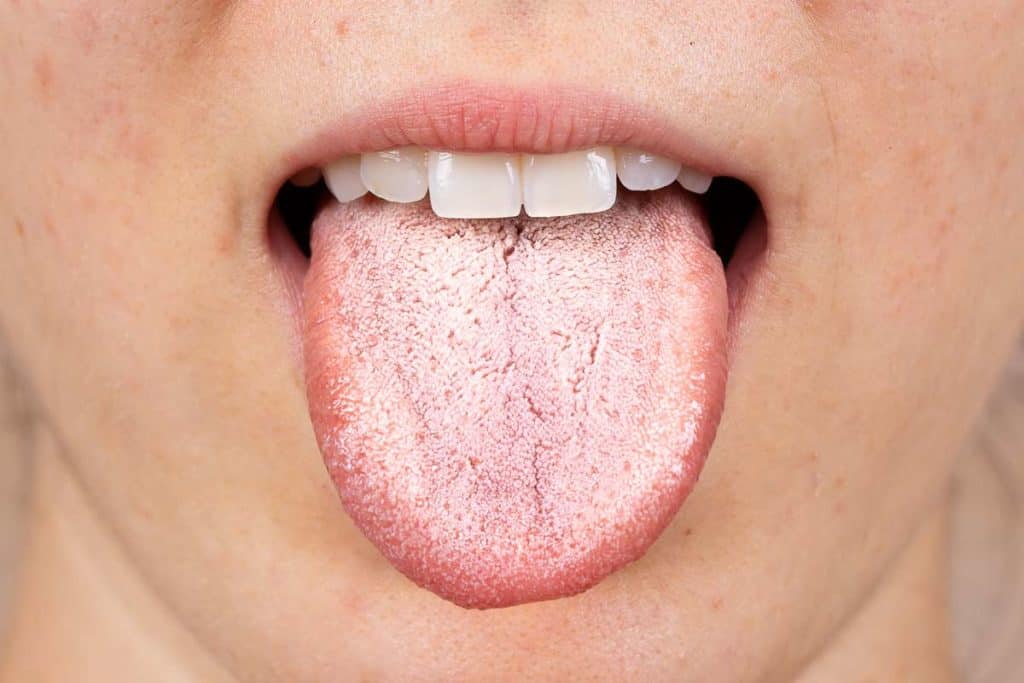 lengua blanca